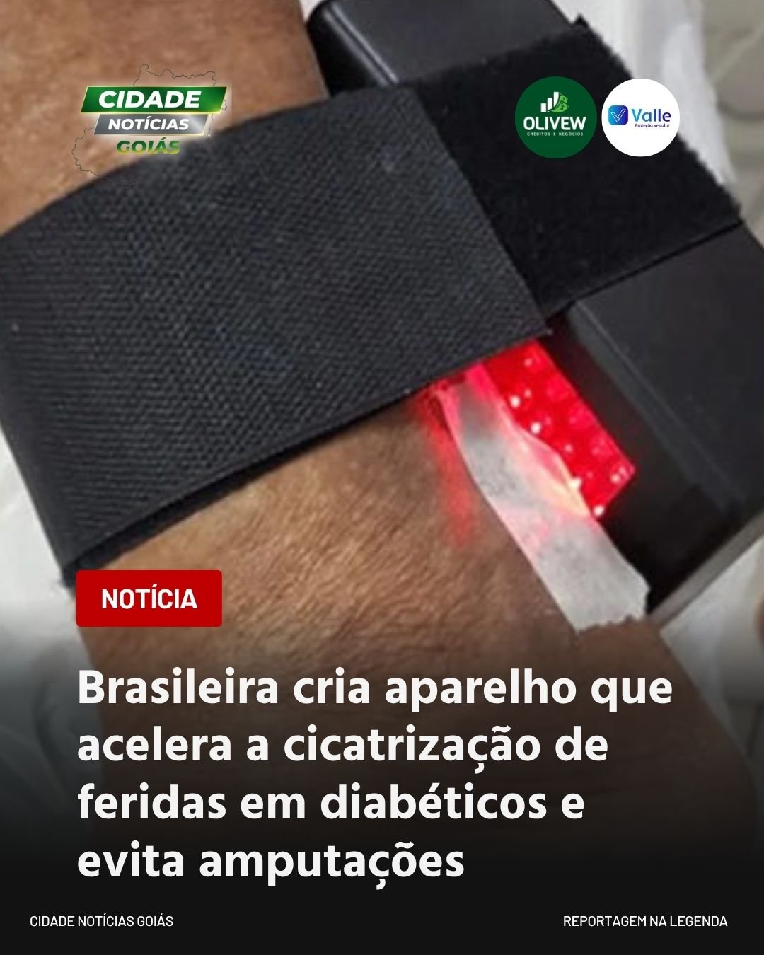 Brasileira cria aparelho que acelera a cicatrização de feridas em diabéticos e evita amputações