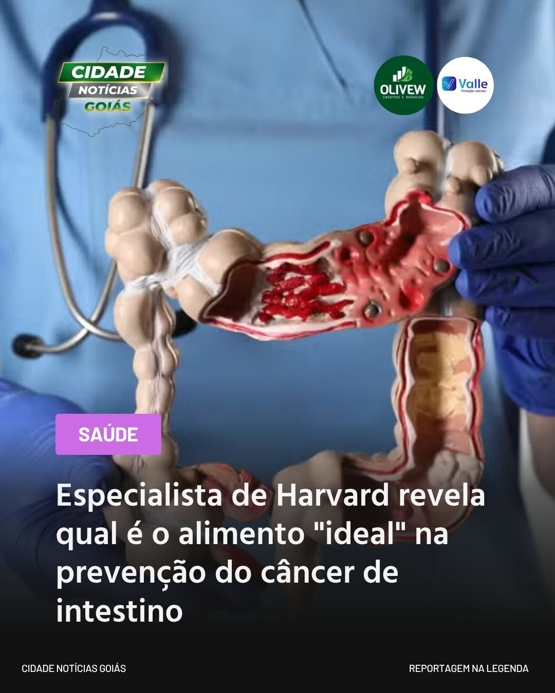 Especialista de Harvard revela qual é o alimento “ideal” na prevenção do câncer de intestino