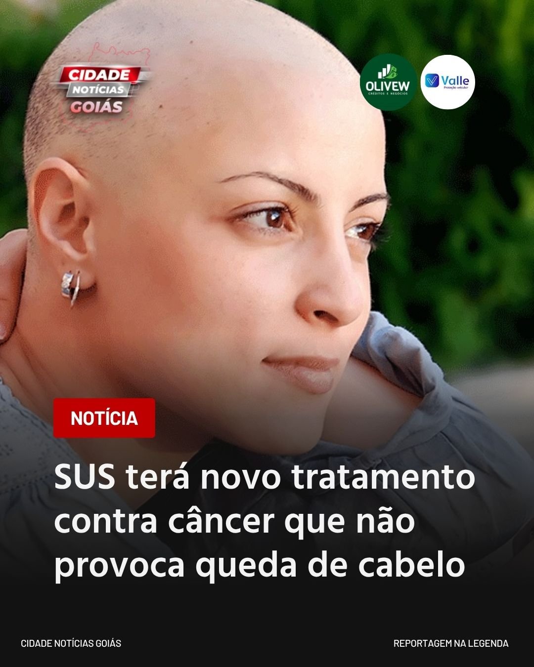 SUS terá novo tratamento contra câncer que não provoca queda de cabelo