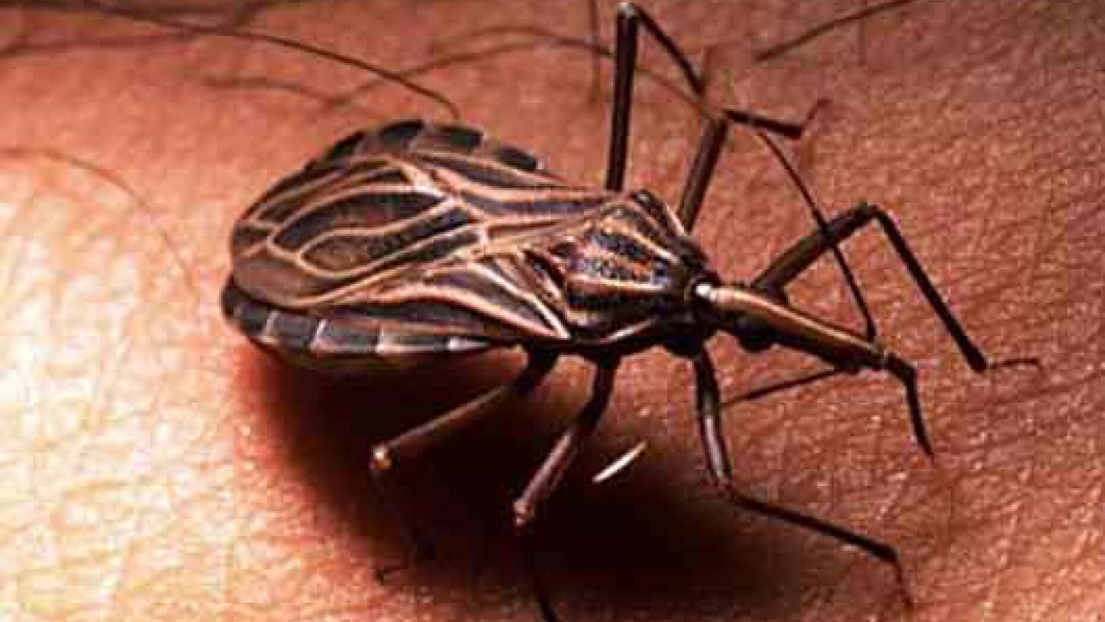 Doença de Chagas volta a crescer no Brasil e acende alerta de prevenção